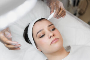 skin needling